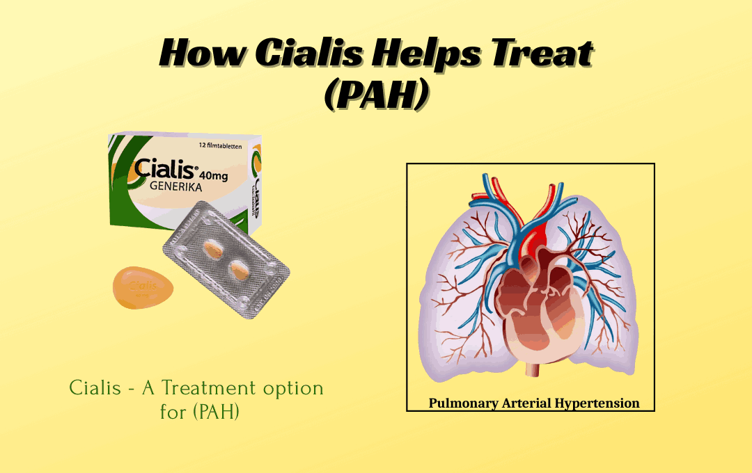Cialis (Tadalafil) for PAH | Complete Treatment Guide